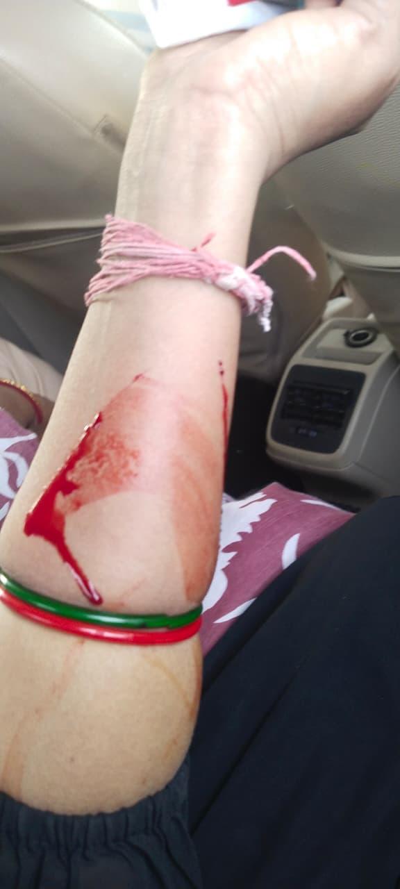 'OMG' ऑफ कैमरा आपबीती: गोद में भूखी मासूम को लिए सरेआम युवकों की छींटाकशी का शिकार होती रही महिला, खींचा, हाथ मरोड़ा,धमकाया और पुलिस ने थाने से ऐसे किया रुखसत कि.