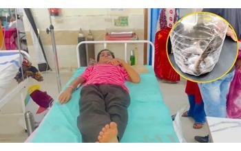 कोबरा के डसने पर शख्स को अस्पताल लाया गया, डॉक्टर ने कहा- सांप भी लाओ; फिर नाग को लेकर पहुंचे परिजन